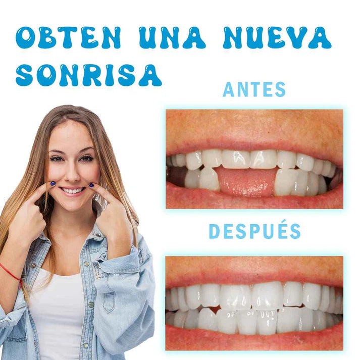 Resina Dental Moldeable 💫
